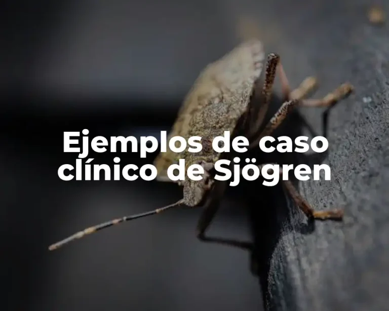 Ejemplos de caso clínico de Sjögren